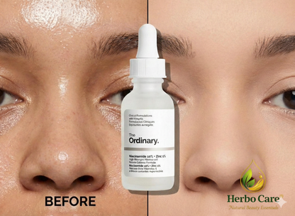 The Ordinary Serum – Buy 1 Get 1 Free